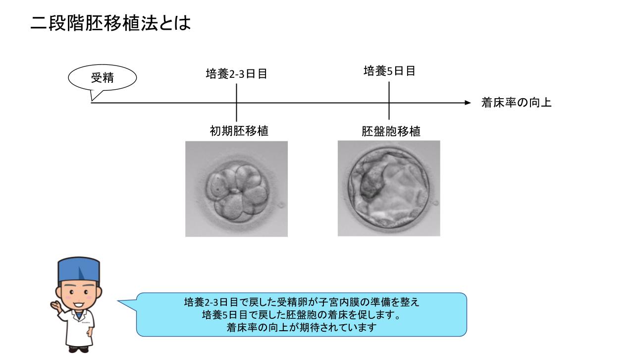 二段階胚移植法
